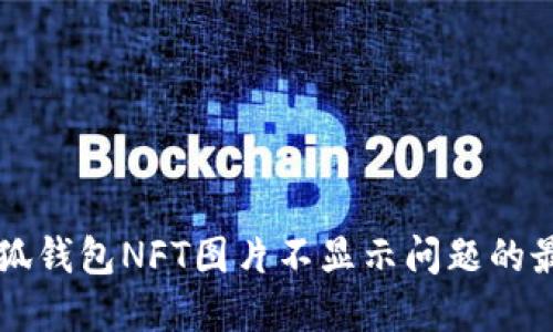 解决小狐钱包NFT图片不显示问题的最佳指南